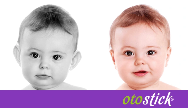 Az Otostick 3 hónapos életkor fölötti gyermekeknél korrigáló ortopéd hatást vált ki.